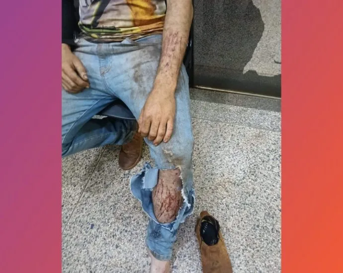 Jovem ferido em suposto ataque de onça em Ponta Porã