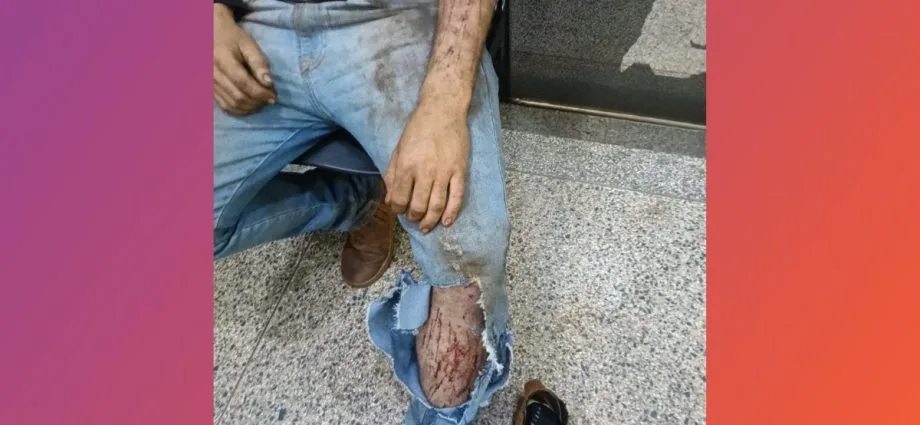 Jovem ferido em suposto ataque de onça em Ponta Porã