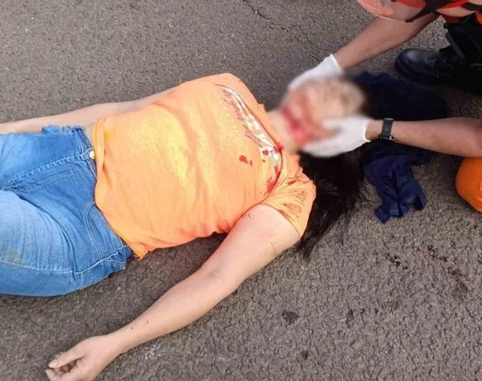 Motociclista sofre ferimentos graves após acidente com fio solto em Campo Grande