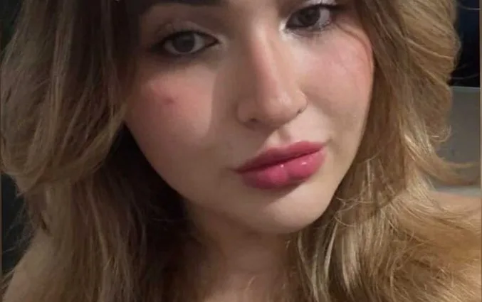 Jovem de 23 anos morre após ser atingida por galho em Campo Grande