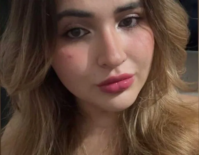 Jovem de 23 anos morre após ser atingida por galho em Campo Grande