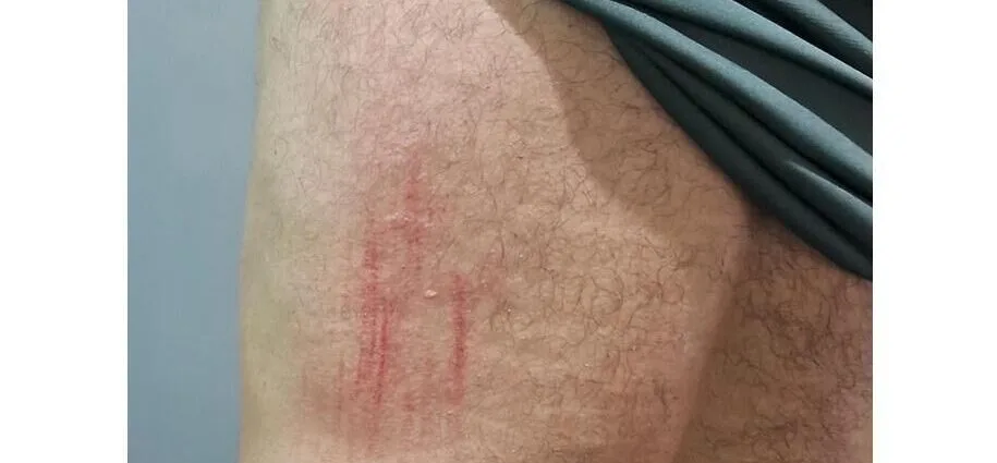 Agente de saúde atacado por pitbull durante visita domiciliar em Ribas do Rio Pardo