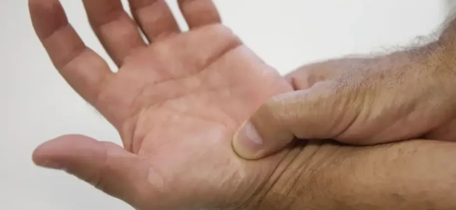 Como solicitar a carteirinha de fibromialgia pela internet em Campo Grande