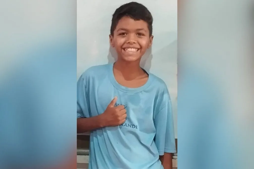 menino corpo incendiado 1