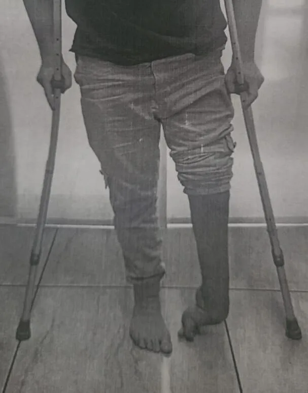 Mãe cria vaquinha para cirurgia do filho de 15 anos em MS