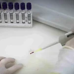Anvisa autoriza testes em humanos de vacina brasileira contra malária