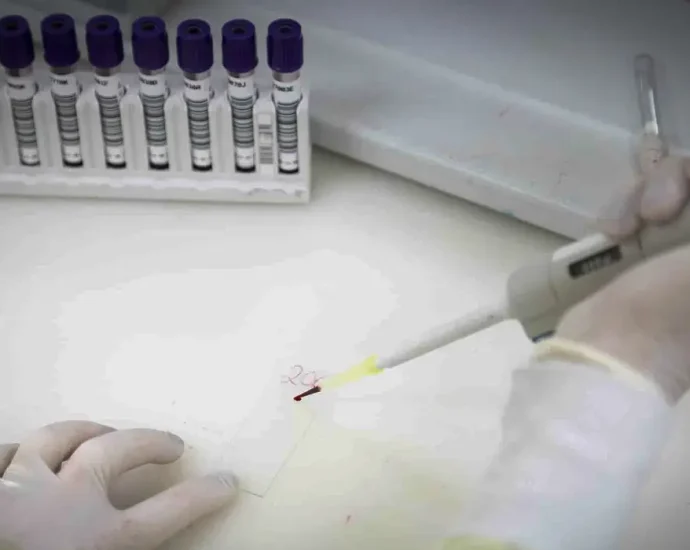 Anvisa autoriza testes em humanos de vacina brasileira contra malária