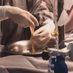 Menino com 60% do corpo queimado passa por procedimento inédito em Campo Grande