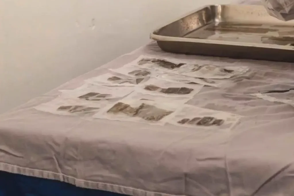 (Foto: Divulgação/Santa Casa)